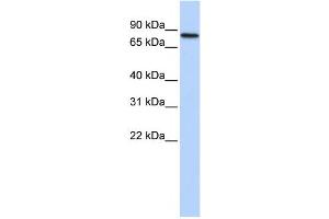 Image no. 1 for anti-Adenosine Deaminase, RNA-Specific, B2 (ADARB2) antibody (ABIN2458539)