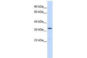Image no. 1 for anti-Mitochondrial Translational Initiation Factor 3 (MTIF3) (Middle Region) antibody (ABIN631213)
