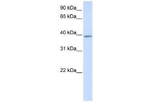 Image no. 1 for anti-Kelch Domain Containing 2 (KLHDC2) (N-Term) antibody (ABIN632311)