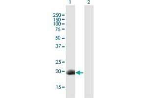 Image no. 1 for anti-Developmental Pluripotency Associated 3 (DPPA3) (AA 1-159) antibody (ABIN1327448)