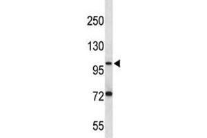 Image no. 4 for anti-Folate Hydrolase (Prostate-Specific Membrane Antigen) 1 (FOLH1) (AA 161-190) antibody (ABIN3030978)
