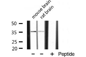 Image no. 3 for anti-POU Domain, Class 4, Transcription Factor 3 (POU4F3) antibody (ABIN6257424)