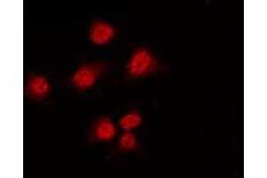 Image no. 2 for anti-Hepatocyte Nuclear Factor 4, alpha (HNF4A) (pSer313) antibody (ABIN6256265)