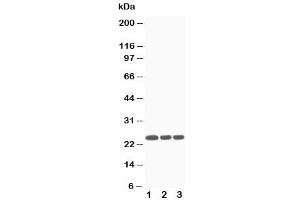 Image no. 2 for anti-Suppressor of Cytokine Signaling 3 (SOCS3) (Middle Region) antibody (ABIN3029044)