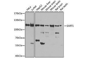 Image no. 2 for anti-Squamous Cell Carcinoma Antigen Recognized By T Cells (SART1) antibody (ABIN6147390)