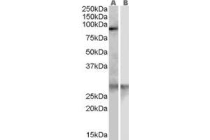 Image no. 1 for anti-Acetyl LDL Receptor (SCARF1) (Internal Region) antibody (ABIN185285)
