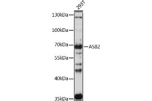 ASB2 抗体  (AA 448-587)