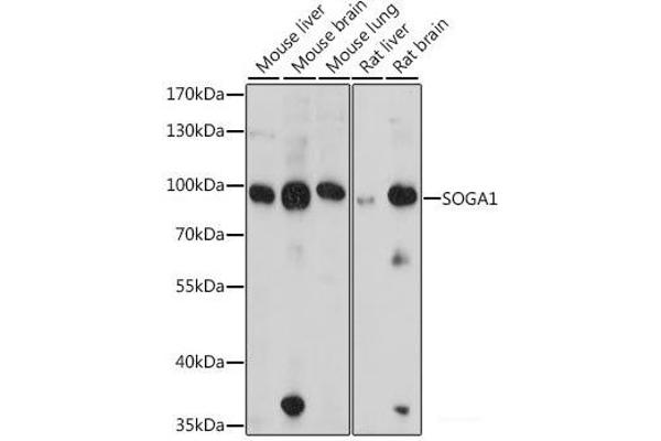 SOGA1 antibody