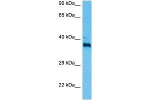 Image no. 2 for anti-Paired-Like Homeodomain 1 (PITX1) (C-Term) antibody (ABIN2780442)