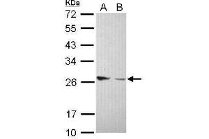 WB Image Sample (30 ug of whole cell lysate) A: IMR32 B: U87-MG 12% SDS PAGE antibody diluted at 1:1000