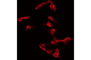 Image no. 3 for anti-Glycogen Synthase 1 (Muscle) (GYS1) (pSer645) antibody (ABIN6256392)