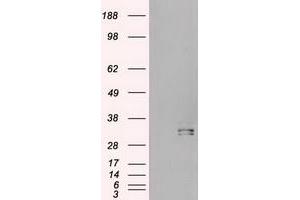 Image no. 2 for anti-Hematopoietically Expressed Homeobox (HHEX) (AA 100-270) antibody (ABIN2722701)