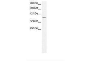 Image no. 1 for anti-Kruppel-Like Factor 8 (KLF8) (AA 226-275) antibody (ABIN6735823)