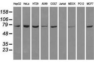 Image no. 3 for anti-Heat Shock 70kDa Protein 1A (HSPA1A) antibody (ABIN2722570)