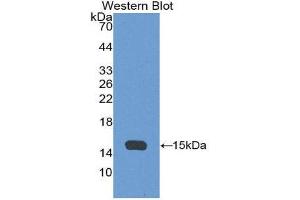Image no. 1 for anti-alpha Hemoglobin Stabilizing Protein (aHSP) (AA 2-102) antibody (ABIN2117578)