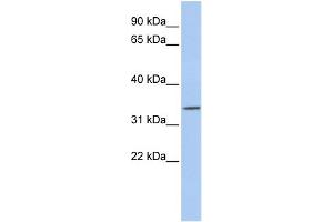 Image no. 1 for anti-Paired-Like Homeodomain 1 (PITX1) (N-Term) antibody (ABIN2779576)