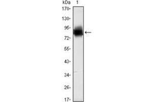 Image no. 2 for anti-Kelch-Like 21 (KLHL21) antibody (ABIN1107981)