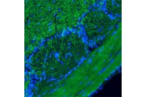 Image no. 6 for anti-Transient Receptor Potential Cation Channel, Subfamily M, Member 8 (TRPM8) (4th Cytoplasmic Loop) antibody (ABIN351223)