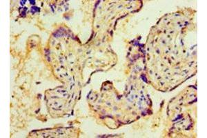 NMNAT3 anticorps  (AA 1-215)