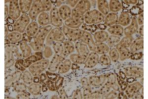Image no. 2 for anti-Disrupted in Renal Carcinoma 1 (DIRC1) antibody (ABIN6259584)