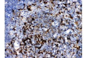 Image no. 3 for anti-Sequestosome 1 (SQSTM1) (AA 69-96), (N-Term) antibody (ABIN3043937)