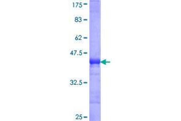 RRM2B Protein (AA 3-84) (GST tag)