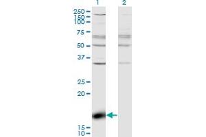 Western Blot analysis of ZBP1 expression in transfected 293T cell line by ZBP1 monoclonal antibody (M01), clone 2C10.