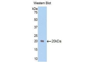 Image no. 1 for anti-Transformer 2 beta Homolog (TRA2B) (AA 64-204) antibody (ABIN1860854)