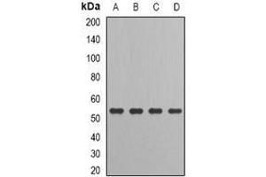 Image no. 1 for anti-Interferon Regulatory Factor 6 (IRF6) (full length) antibody (ABIN6005294)