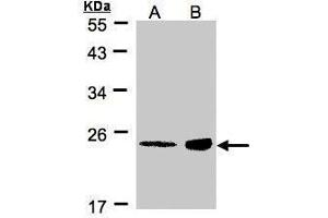 Image no. 3 for anti-R-Ras (Center) antibody (ABIN2856128)