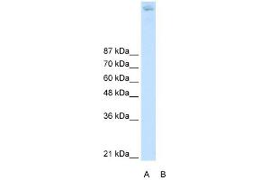 Image no. 2 for anti-Zinc Finger and BTB Domain Containing 38 (ZBTB38) (N-Term) antibody (ABIN925950)
