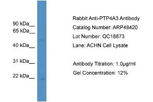 Image no. 1 for anti-Protein Tyrosine Phosphatase Type IVA, Member 3 (PTP4A3) (C-Term) antibody (ABIN2773919)