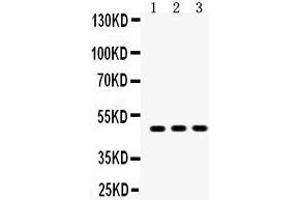Image no. 6 for anti-Sequestosome 1 (SQSTM1) (AA 69-96), (N-Term) antibody (ABIN3043937)