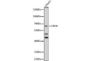 CRNN antibody  (AA 396-495)