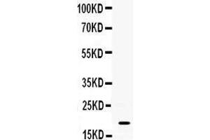 Image no. 2 for anti-S100 Calcium Binding Protein A8 (S100A8) (AA 2-89) antibody (ABIN3042481)