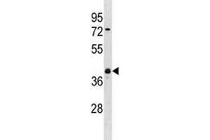 Image no. 1 for anti-Ubiquitin Carboxyl-terminal Hydrolase L5 (UCHL5) (AA 136-164) antibody (ABIN3029427)
