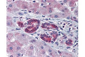 Image no. 4 for anti-T-Cell Acute Lymphocytic Leukemia 1 (TAL1) (C-Term) antibody (ABIN2792541)