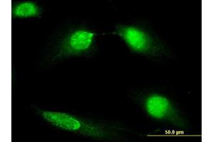 Immunofluorescence of monoclonal antibody to DIAPH3 on HeLa cell.