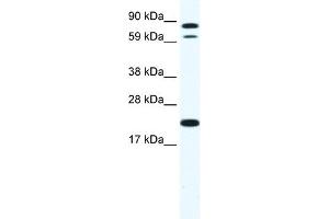 Image no. 1 for anti-Zinc Finger Protein 287 (ZNF287) (N-Term) antibody (ABIN2780099)