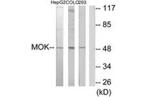 Image no. 1 for anti-MOK Protein Kinase (MOK) (AA 261-310) antibody (ABIN1534199)