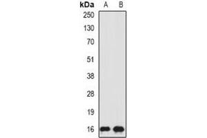 Image no. 3 for anti-Signal Recognition Particle 19kDa (SRP19) antibody (ABIN2967063)