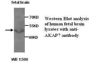 Image no. 1 for anti-A Kinase (PRKA) Anchor Protein 7 (AKAP7) antibody (ABIN6583507)