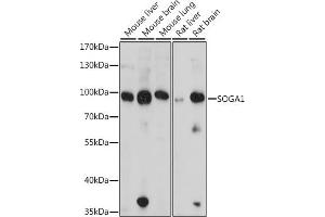 SOGA1 抗体  (AA 650-750)