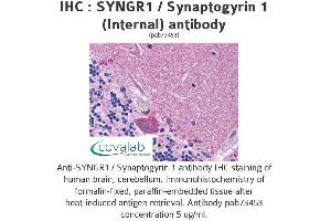 Image no. 1 for anti-Synaptogyrin 1 (SYNGR1) (Internal Region) antibody (ABIN1739824)
