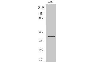 Image no. 1 for anti-Sarcoglycan, beta (43kDa Dystrophin-Associated Glycoprotein) (SGCB) (Internal Region) antibody (ABIN3186878)