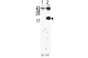 Image no. 3 for anti-FK506 Binding Protein 1A, 12kDa (FKBP1A) (AA 43-74) antibody (ABIN3030968)