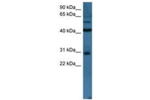 Image no. 1 for anti-T-Cell Leukemia Homeobox 2 (TLX2) (N-Term) antibody (ABIN6746163)