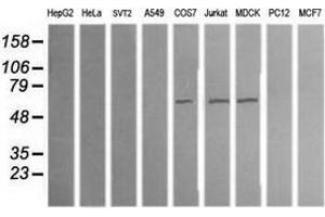 Image no. 2 for anti-Aldehyde Dehydrogenase 1 Family, Member A3 (ALDH1A3) (AA 1-100), (AA 413-512) antibody (ABIN2715885)