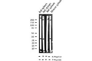 Image no. 4 for anti-Cyclin D3 (CCND3) (pThr283) antibody (ABIN6255654)