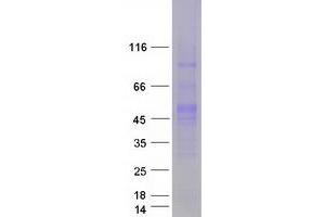 Image no. 1 for POU Class 5 Homeobox 1 (POU5F1) (Transcript Variant 1) protein (Myc-DYKDDDDK Tag) (ABIN2727872)